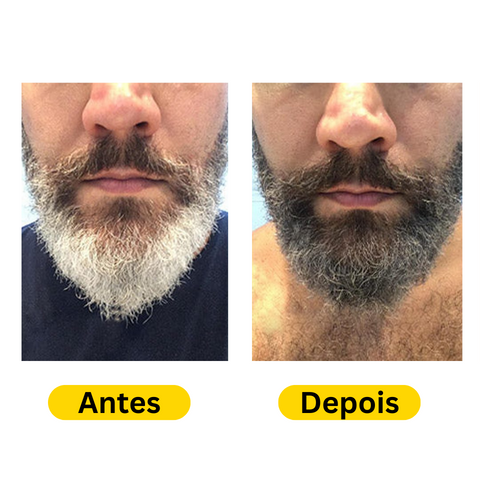 NaturaDark® - Shampoo