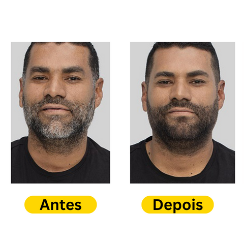 NaturaDark® - Shampoo