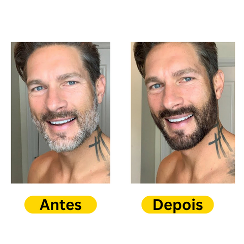 NaturaDark® - Shampoo